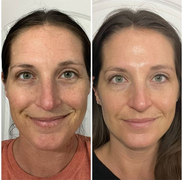 Luvidora Sculpt™ — Neck & Face Toning Wand