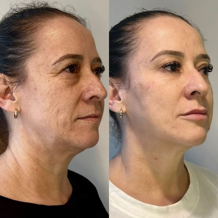 Luvidora Sculpt™ — Neck & Face Toning Wand