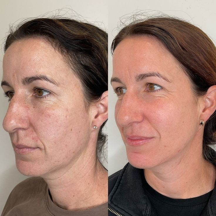 Luvidora Sculpt™ — Neck & Face Toning Wand