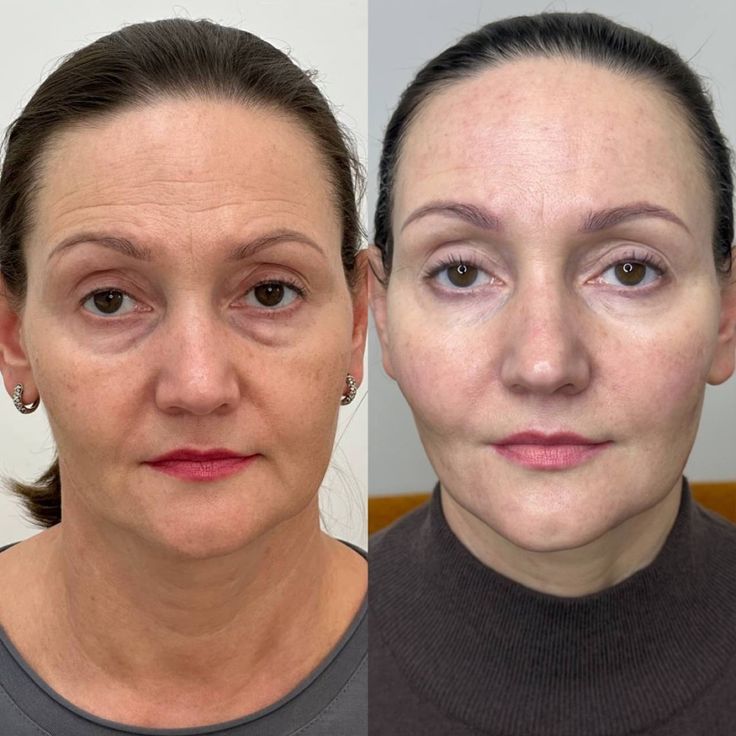 Luvidora Sculpt™ — Neck & Face Toning Wand