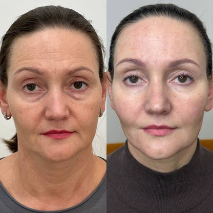 Luvidora Sculpt™ — Neck & Face Toning Wand